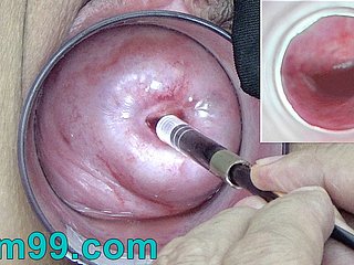 Japanese Endoscope Camera dominant Cervix Cam buy Vagina